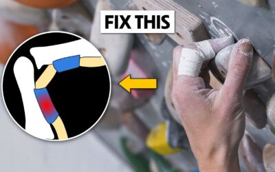 How to Fix Climbing's Most Common Injury