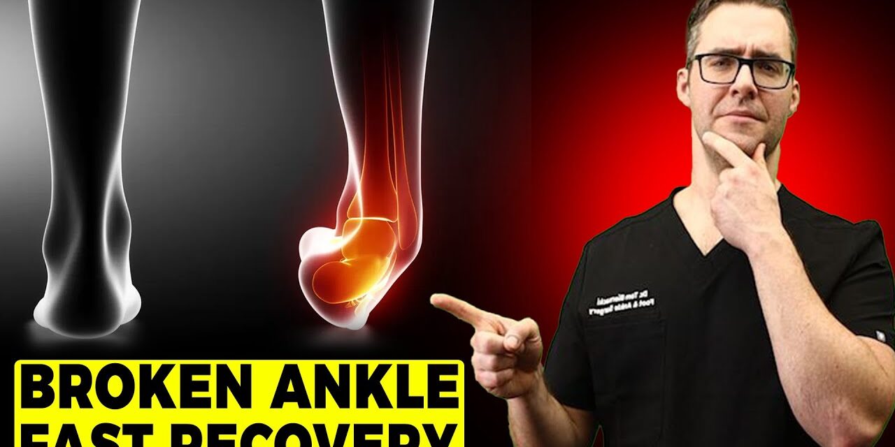 BEST Ankle Fracture & Broken Ankle Recovery Time 2024 [25 BEST TIPS!]