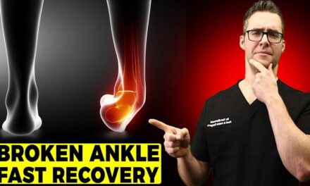 BEST Ankle Fracture & Broken Ankle Recovery Time 2024 [25 BEST TIPS!]