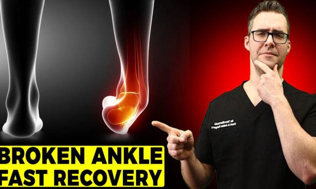BEST Ankle Fracture & Broken Ankle Recovery Time 2024 [25 BEST TIPS!]
