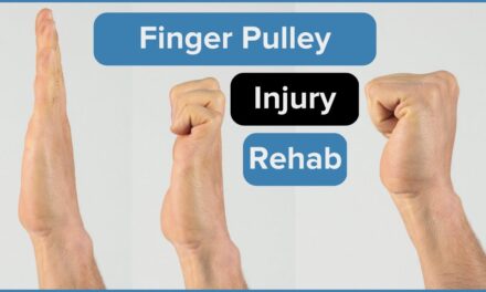 How To Rehab a Climbing Pulley Injury