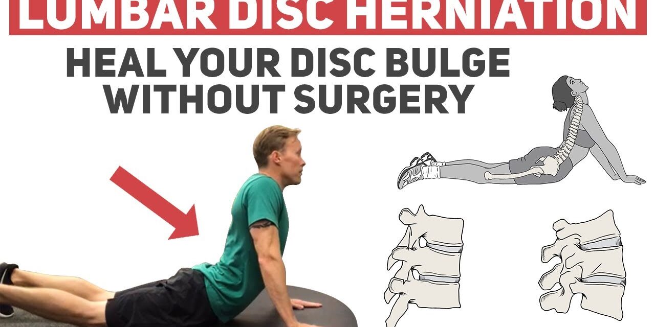 How to Heal Your Disc Herniation Without Surgery