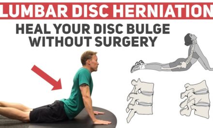 How to Heal Your Disc Herniation Without Surgery