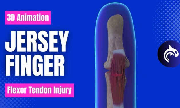 Jersey Finger (Flexor Tendon) Injury and Surgery – 3D animation