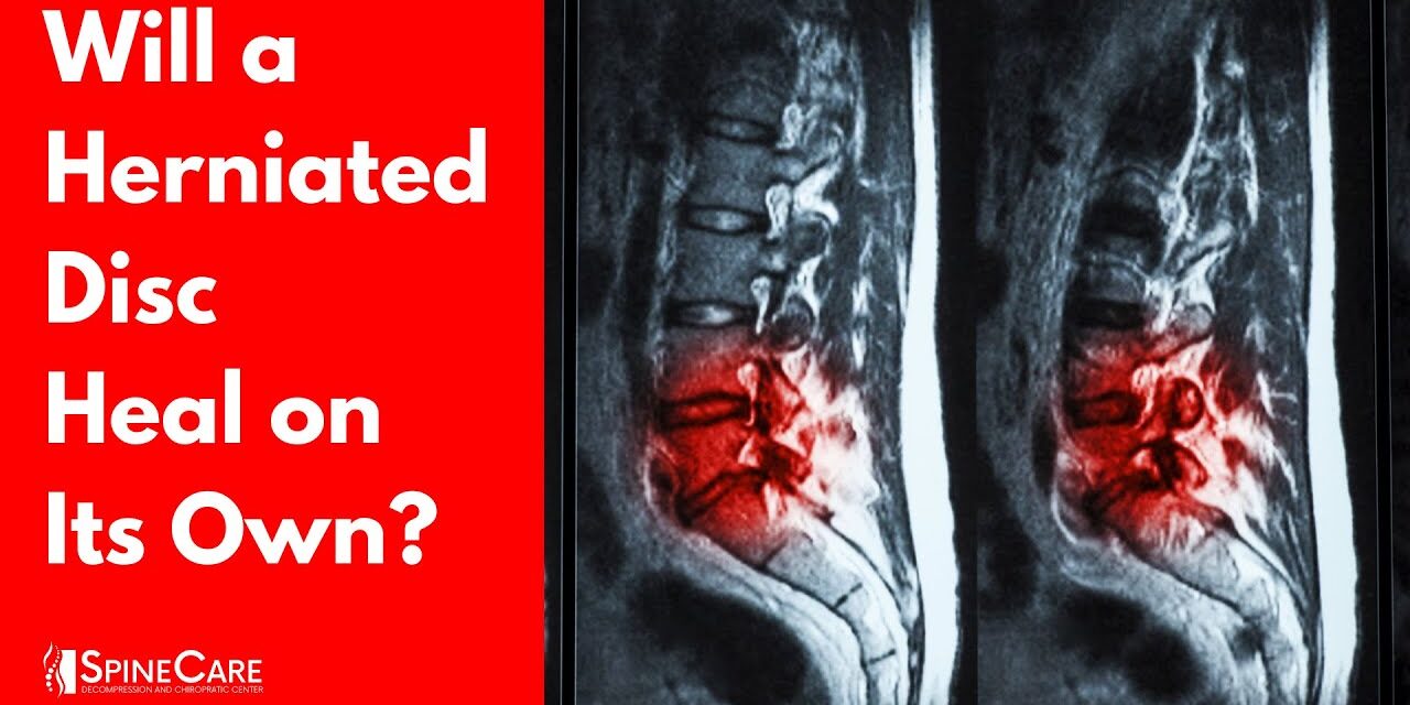Will a Herniated Disc Heal on Its Own? (SURPRISING ANSWER)