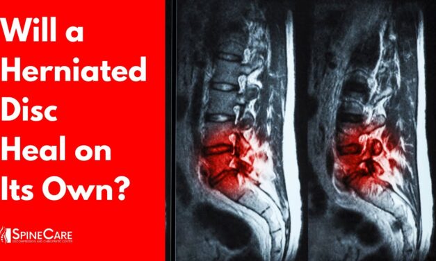 Will a Herniated Disc Heal on Its Own? (SURPRISING ANSWER)