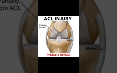 5 Best ACL Recovery Exercises | Phase 1 Rehab