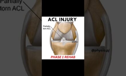 5 Best ACL Recovery Exercises | Phase 1 Rehab