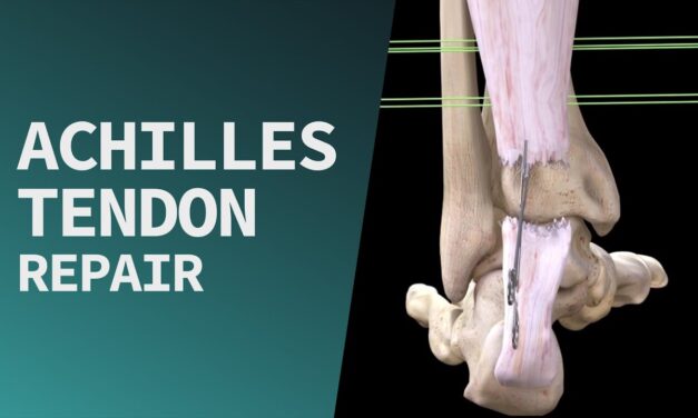 Achilles Tendon Repair
