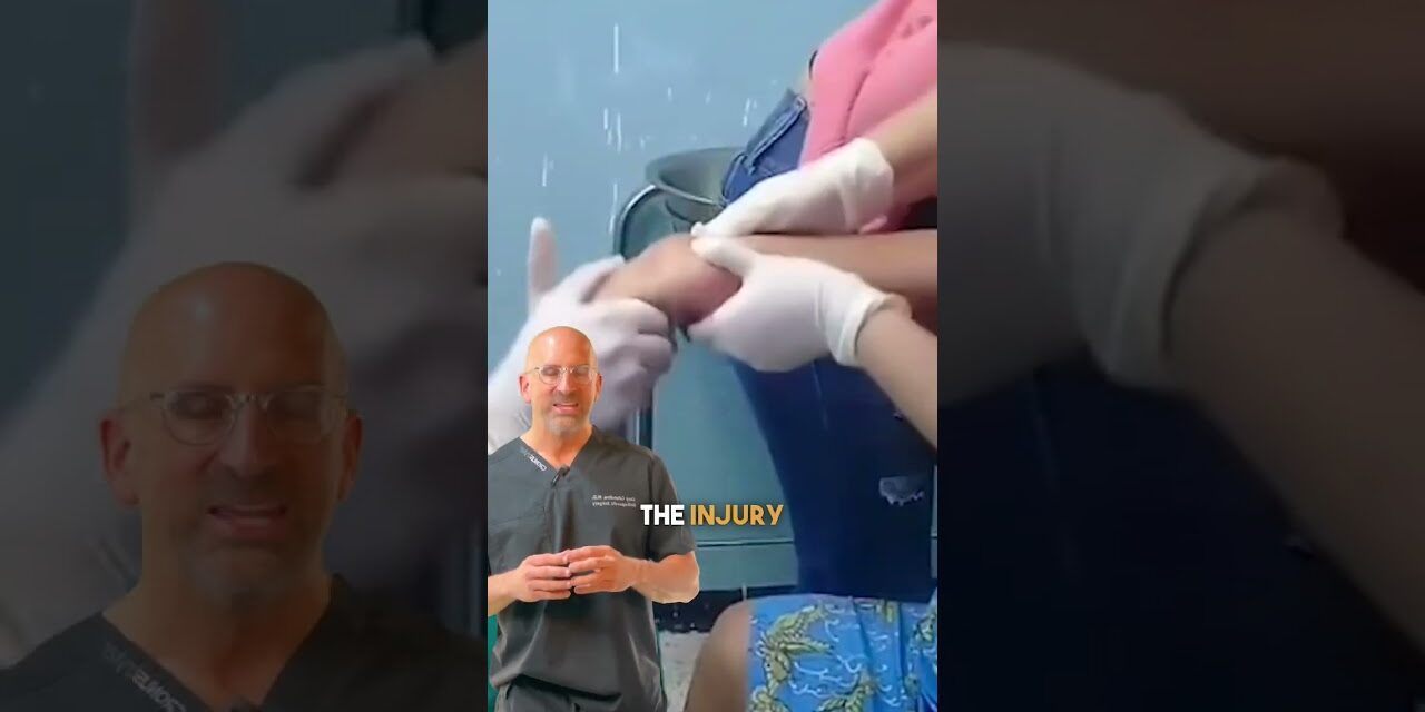 Cranking-on a Wrist Fracture  #shorts