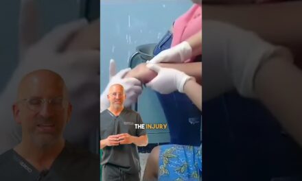 Cranking-on a Wrist Fracture  #shorts