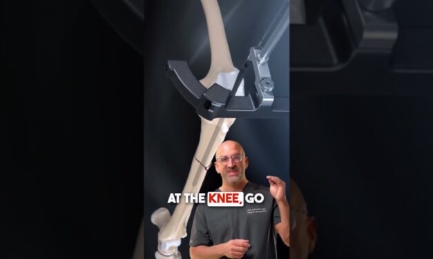 Extreme (and effective) Broken Leg Fix #shorts