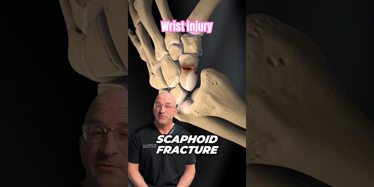 Frequently Misdiagnosed Reason Your Wrist Hurts #shorts