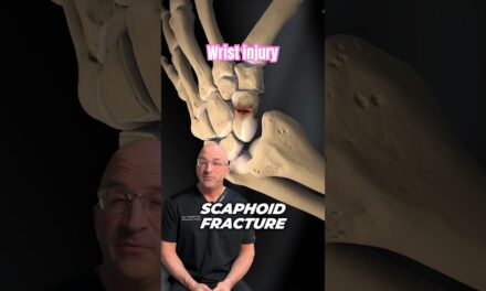 Frequently Misdiagnosed Reason Your Wrist Hurts #shorts