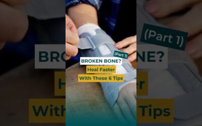 PART 1: FRACTURE? Speed Healing With These Top Tips!