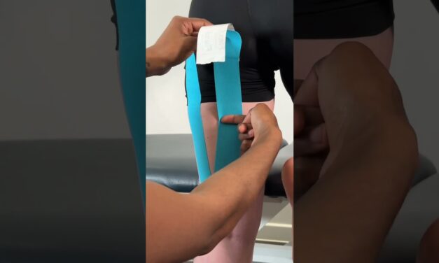 Sports taping a hamstring injury for support and stability #sportstape #hamstringinjury #physio