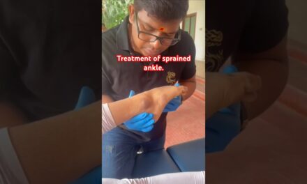 Chiropractic Treatment of sprained ankle. #drrajneeshkant #worldfamouschiropractor