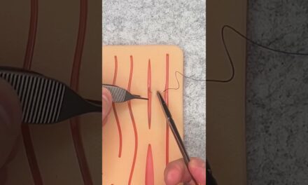 How to suture  #doctor #surgery #surgeon #stitches