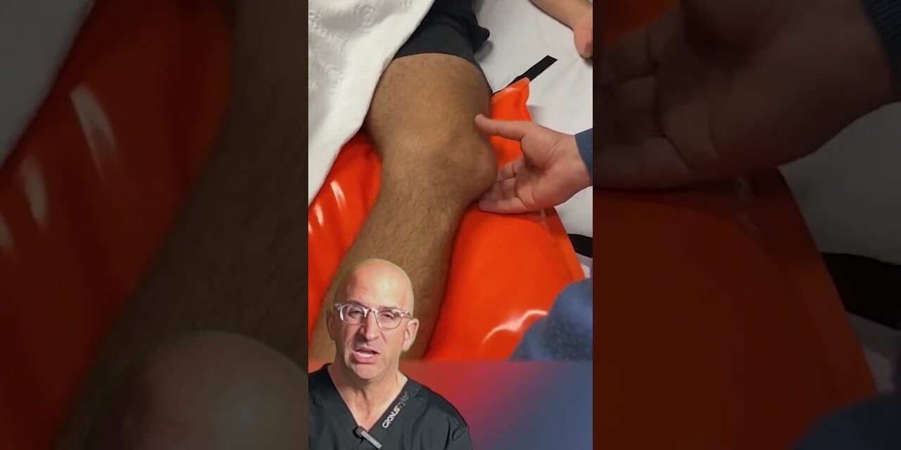 Kneecap Dislocation: Symptoms, Causes, and Reduction Techniques #shorts