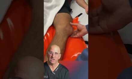 Kneecap Dislocation: Symptoms, Causes, and Reduction Techniques #shorts