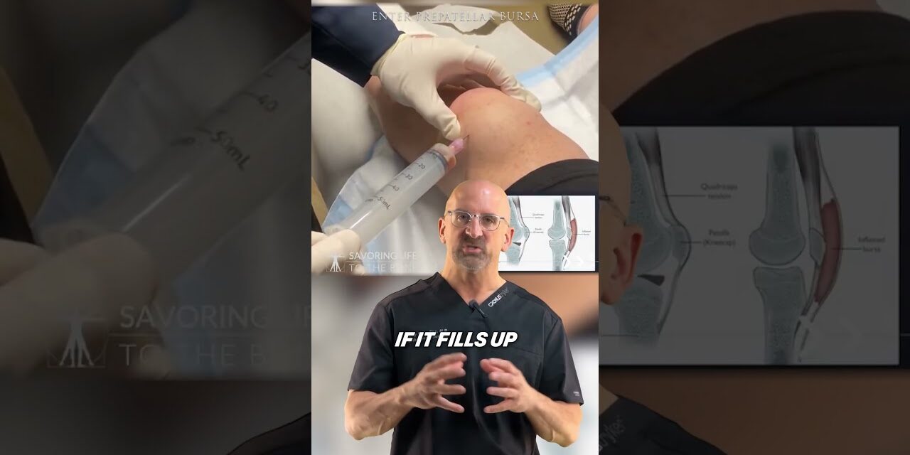 Quick Fix for Swollen Knee #shorts