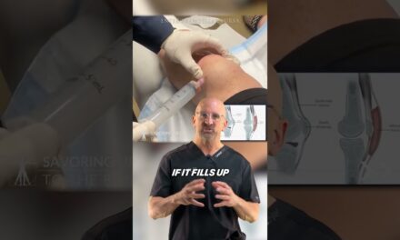 Quick Fix for Swollen Knee #shorts