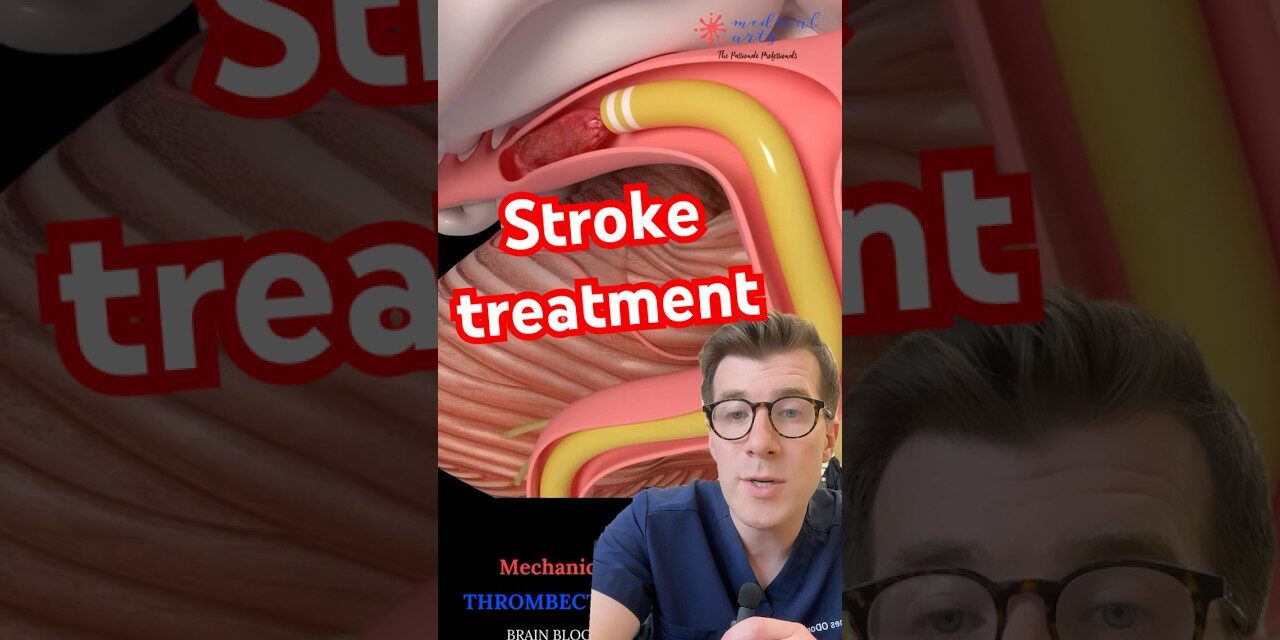 Doctor explains STROKE TREATMENT – clot removal #shorts