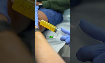 How to alleviate knee pain? #kneepain #painmanagment #painrelief