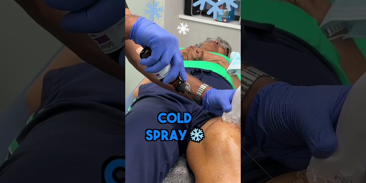 Knee Joint Aspiration – Osteoarthritis of the knee