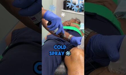 Knee Joint Aspiration – Osteoarthritis of the knee