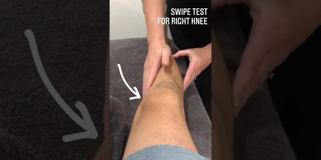 This test is used in the clinic to assess for a knee effusion, or swelling in the knee joint