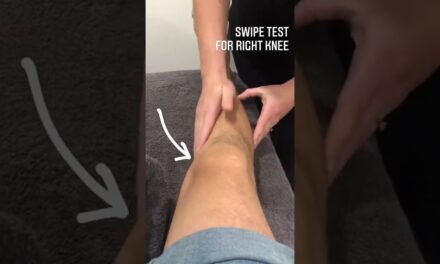 This test is used in the clinic to assess for a knee effusion, or swelling in the knee joint