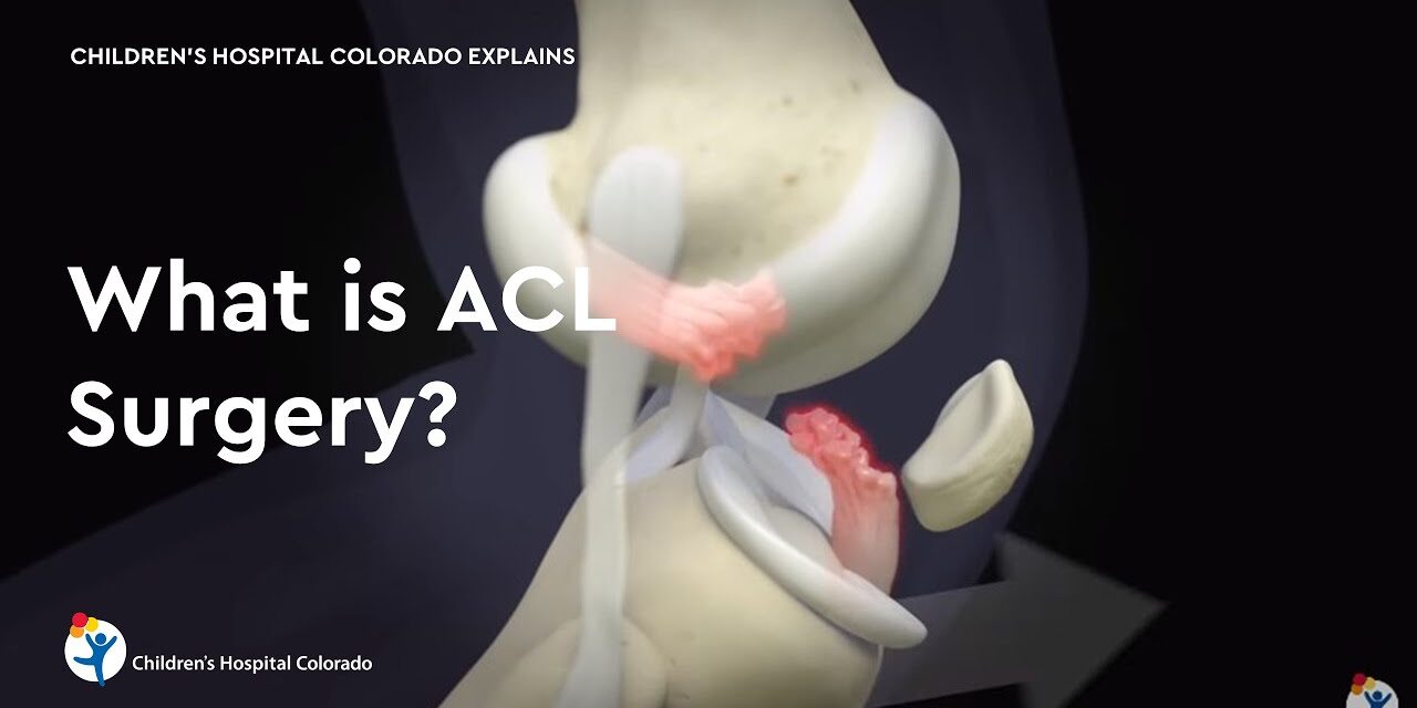 What is ACL Surgery?