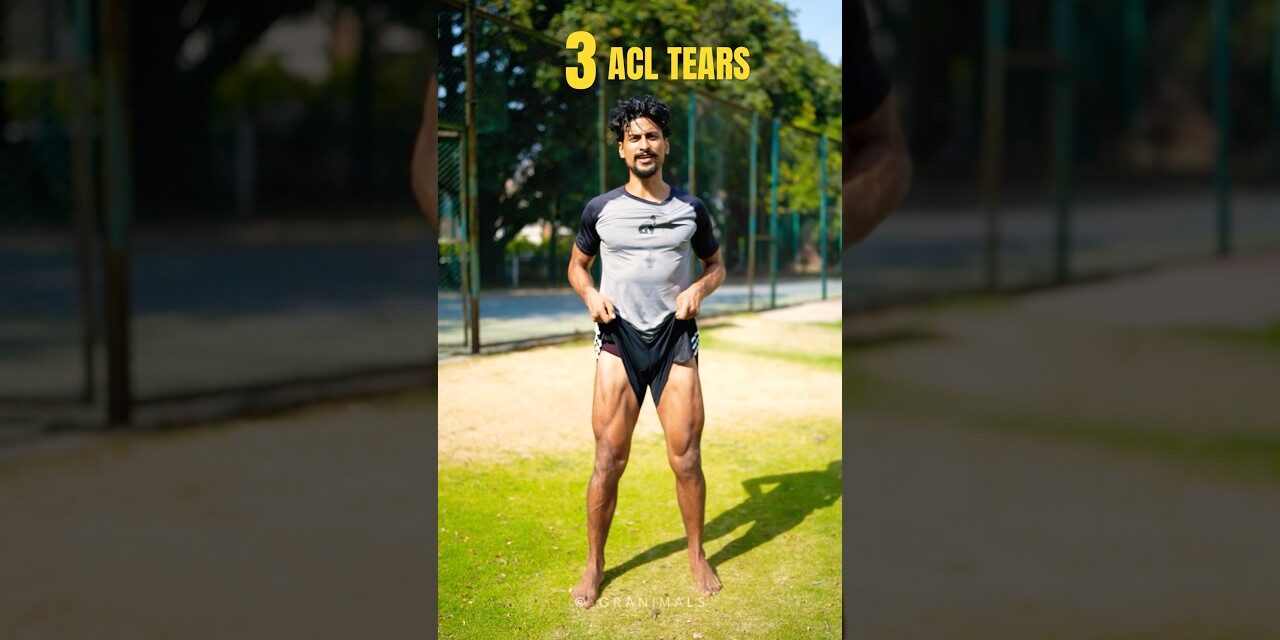 3 ACL Tears | ACL Injury #aclinjury #acltear #aclrecovery