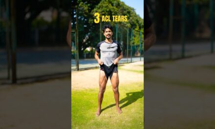 3 ACL Tears | ACL Injury #aclinjury #acltear #aclrecovery